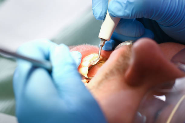 Best After-Hours Emergency Dentist in Mount Hope, WV