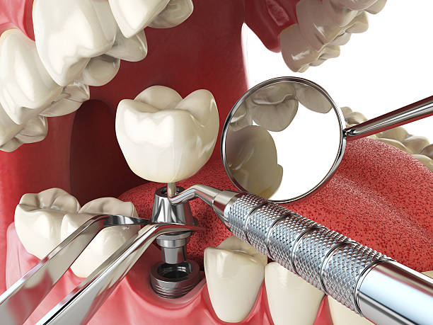Best Emergency Dental Care for Trauma or Injury in Mount Hope, WV